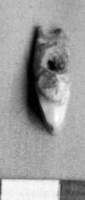Human tooth pendant 2